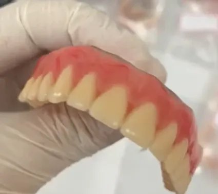 🦷 Sorriso Renovado: G Carvalho Soluções transforma vidas com próteses dentárias!